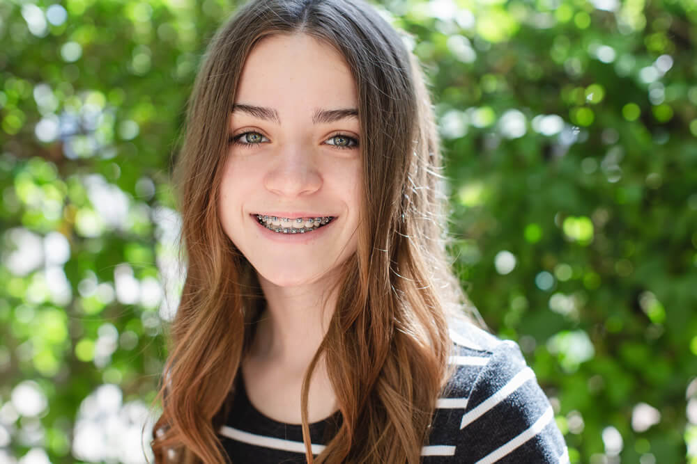 Young Orthodontics Smile Gallery